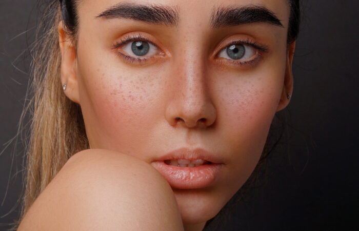 Nici liftingujące COG 4D