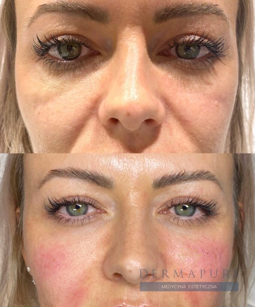 4a17dff0-020d-435e-b193-422f8699ab8e