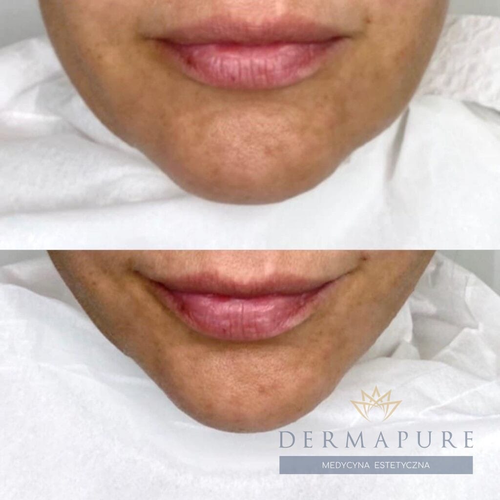 nici_liftingujace_kwadrat